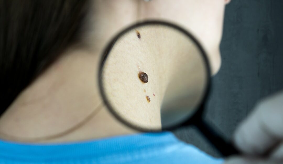 The Role of a Dermatologist in Treating Skin Conditions
